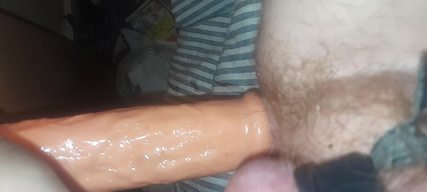 Solo anal dilatation 